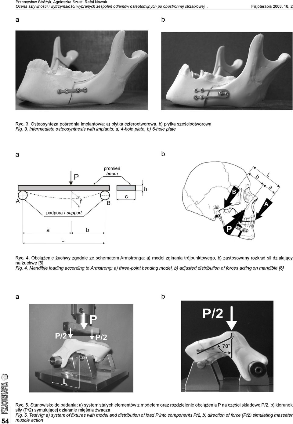 hole plte, ) 6-hole plte promień em podpor / support Ryc. 4. Ociążenie żuchwy zgodnie ze schemtem Armstrong: ) model zginni trójpunktowego, ) zstosowny rozkłd sił dziłjący n żuchwę [6] Fig. 4. Mndile loding ccording to Armstrong: ) three-point ending model, ) djusted distriution of forces cting on mndile [6] 54 Ryc.