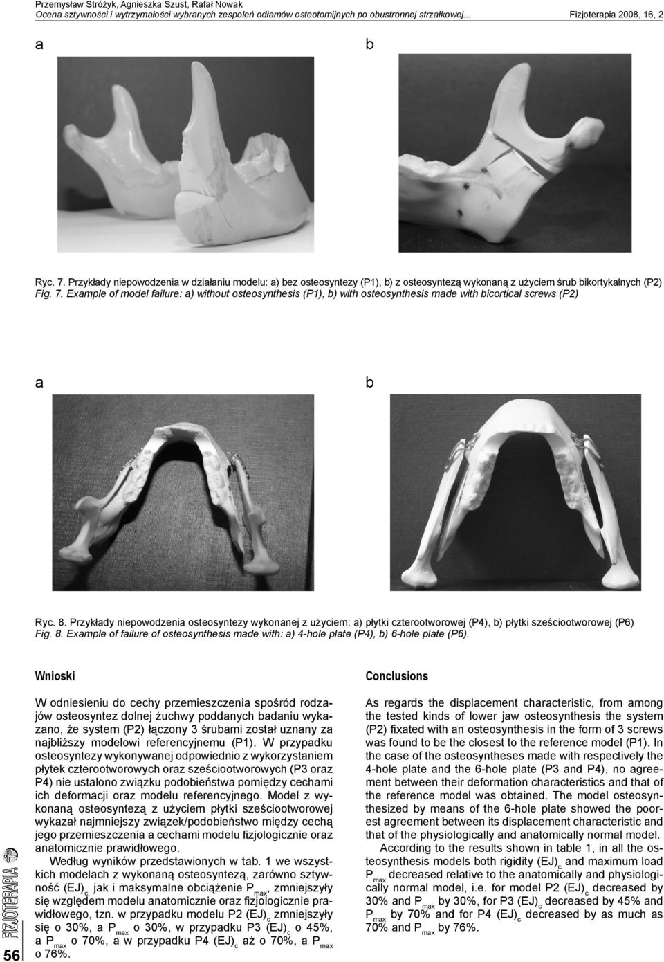 Exmple of model filure: ) without osteosynthesis (P1), ) with osteosynthesis mde with icorticl screws (P2) Ryc. 8.