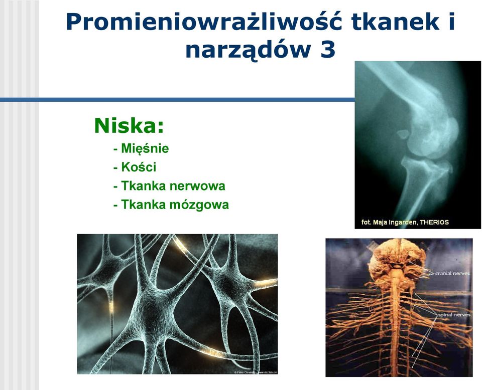 Niska: - Mięśnie - Kości