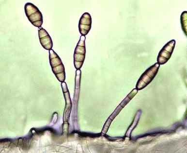 Rodzaj Botrytis charakteryzuje się wełnistą grzybnią jasnoszarą lub oliwkowobrunatną z szarą warstwą konidiów.