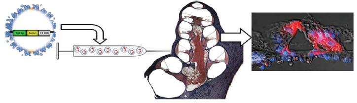 ATOH1 badania kliniczne Parker Mark A et al.