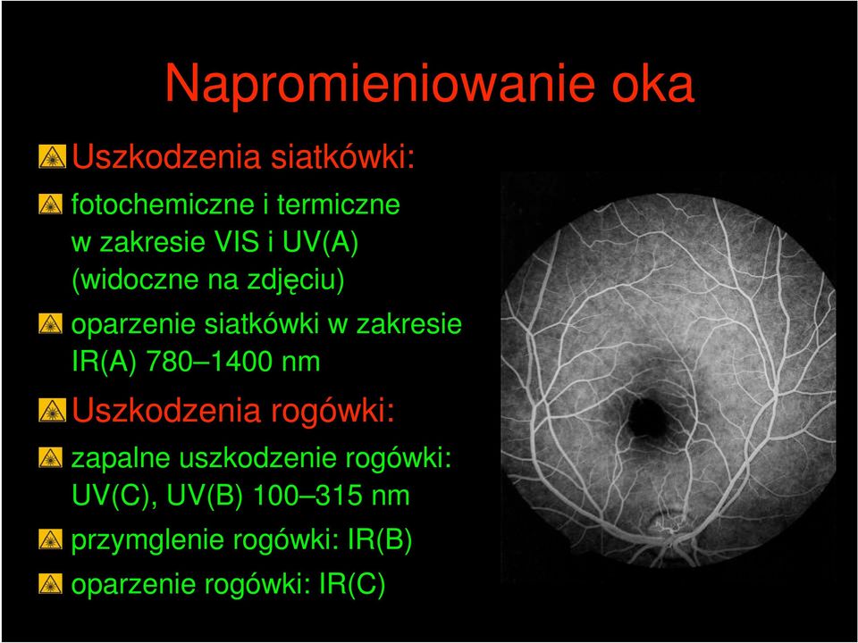 zakresie IR(A) 780 1400 nm Uszkodzenia rogówki: zapalne uszkodzenie