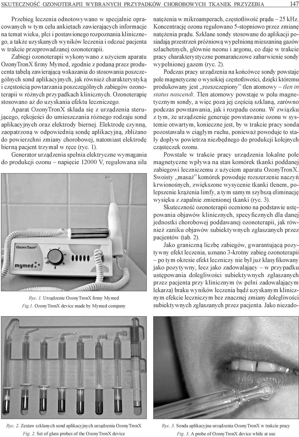 Zabiegi ozonoterapii wykonywano z użyciem aparatu OzonyTronX firmy Mymed, zgodnie z podaną przez producenta tabelą zawierającą wskazania do stosowania poszczególnych sond aplikacyjnych, jak również