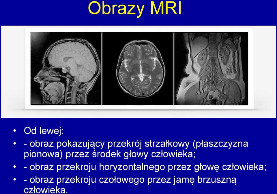 człowieka; - obraz przekroju horyzontalnego przez głowę