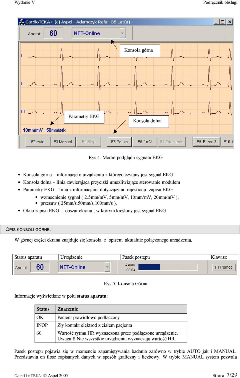 informacjami dotyczącymi rejestracji zapisu EKG wzmocnienie sygnał ( 2.
