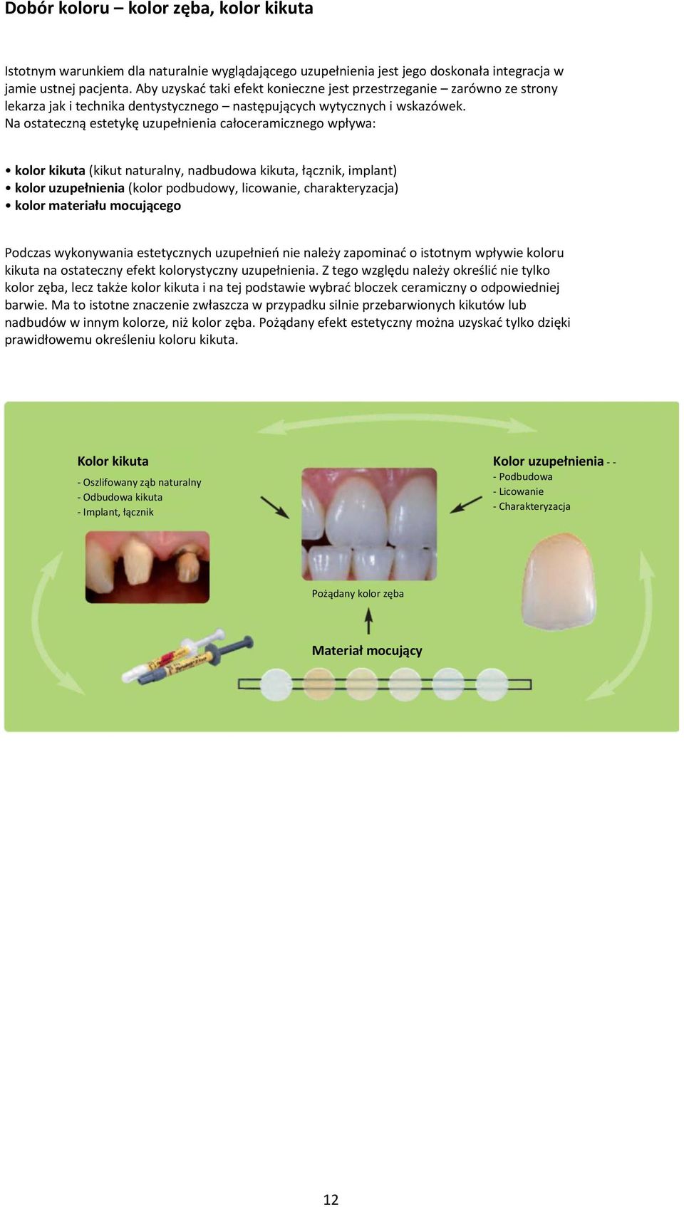 Na ostateczną estetykę uzupełnienia całoceramicznego wpływa: kolor kikuta (kikut naturalny, nadbudowa kikuta, łącznik, implant) kolor uzupełnienia (kolor podbudowy, licowanie, charakteryzacja) kolor