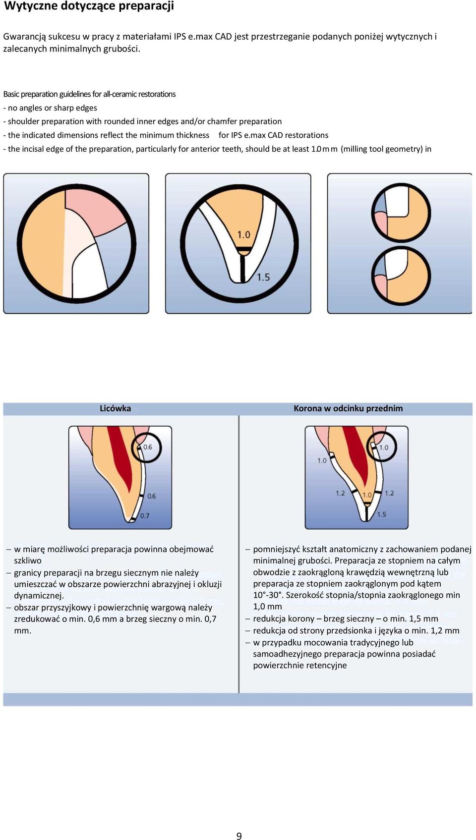 minimum thickness for IPS e.max CAD restorations - the incisal edge of the preparation, particularly for anterior teeth, should be at least 1.