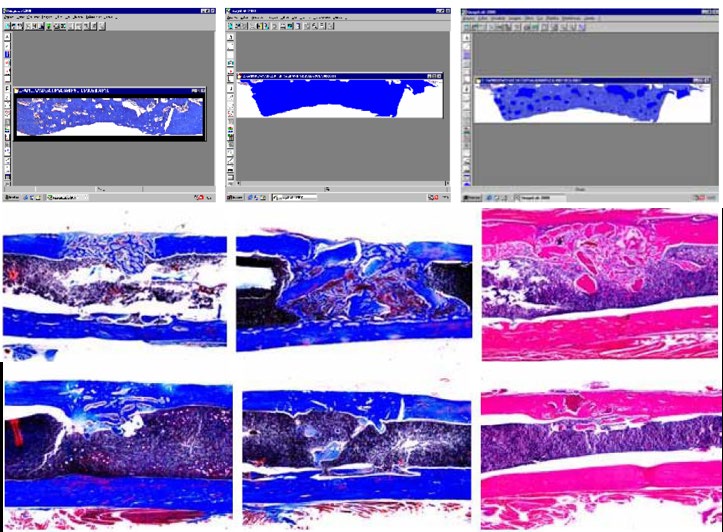 Charakterystyka produktu Stosunek Ca/P Oznaczenie stosunku Ca/P zostało przeprowadzone zgodnie z ISO 13779-3:2008 Iten 10.3 Ułamek wagowy wapnia w Bonefill Dense wynosi średnio 23.63% (0.