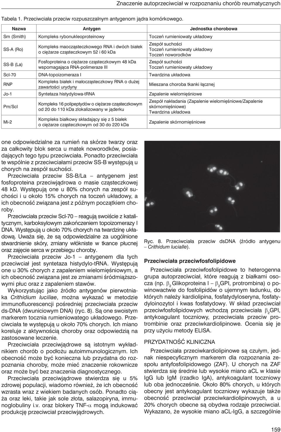 60 kda Fosfoproteina o ciężarze cząsteczkowym 48 kda wspomagająca RNA-polimeraze III Zespół suchości Toczeń rumieniowaty układowy Toczeń noworodków Zespół suchości Toczeń rumieniowaty układowy Scl-70