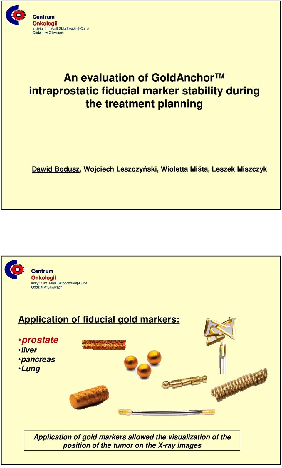 Miszczyk Application of fiducial gold markers: prostate liver pancreas Lung