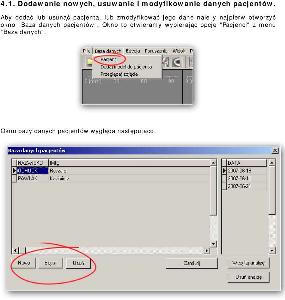 otworzyć okno "Baza danych pacjentów".