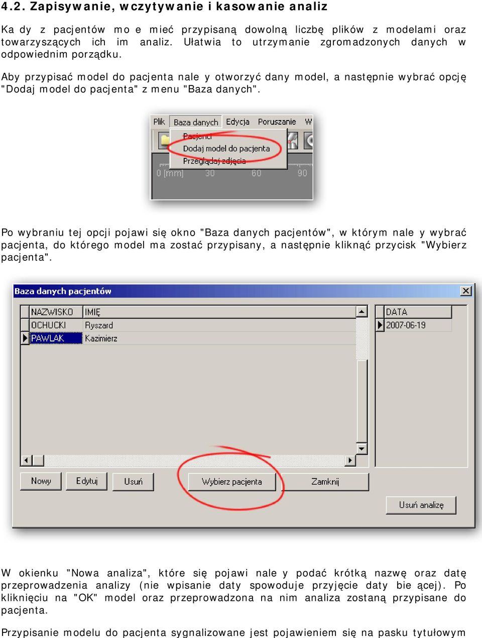 Po wybraniu tej opcji pojawi się okno "Baza danych pacjentów", w którym należy wybrać pacjenta, do którego model ma zostać przypisany, a następnie kliknąć przycisk "Wybierz pacjenta".