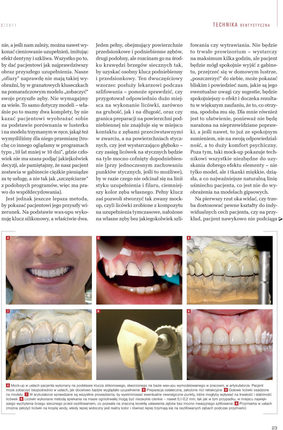 To samo dotyczy modeli wła śnie po to mamy dwa komplety, by nie kazać pacjentowi wyobrażać sobie na podstawie porównania w lusterku i na modelu trzymanym w ręce, jakąż też wymyśliliśmy dla niego