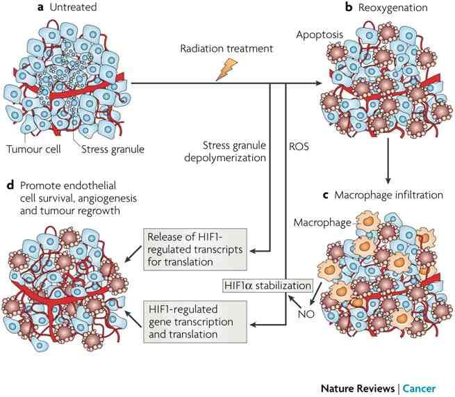 EKSPRESJA HIF-1 w RADIOTERAPII