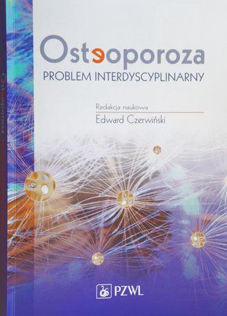 SYSTEM ZAPOBIEGANIA ZŁAMANIOM W POLSCE Przygotowania www.osteoporoza.