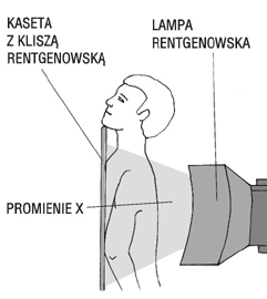 Żeby to wyjaśnić, przypomnijmy, jak działa aparat rentgenowski Promieniowanie rentgenowskie wytwarzane jest w specjalnej