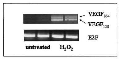 Nadtlenek wodoru indukuje syntezę VEGF