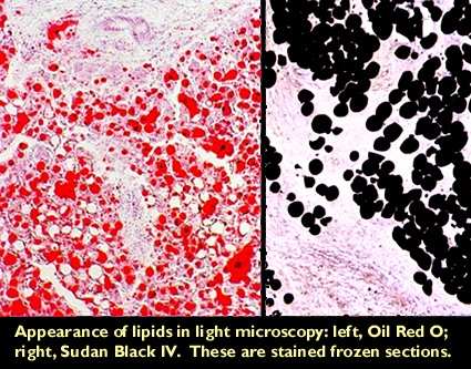 Wykrywanie lipidów Do histochemicznego wykrywania lipidów uŝywa się głównie barwników wykazujących niską rozpuszczalność w wodzie i alkoholu, natomiast wysoką w tłuszczach (barwnik rozpuszcza się w