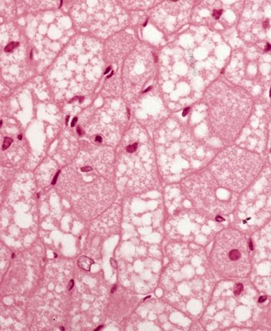 Tkanka tłuszczowa brunatna Wielopęcherzykowa Termogeneza Mitochondria (cytochromy nadają im barwę