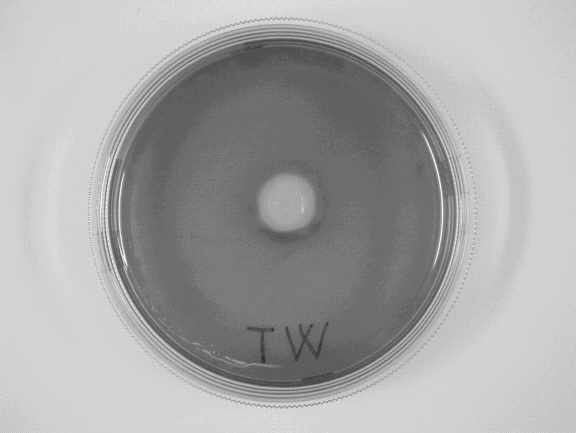 interaction with toxic material. Then, the scale of a toxic influence will be the zone of the white (dead) cells FIG. 4. There were no toxic impacts against investigated cells in our case FIG. 5.