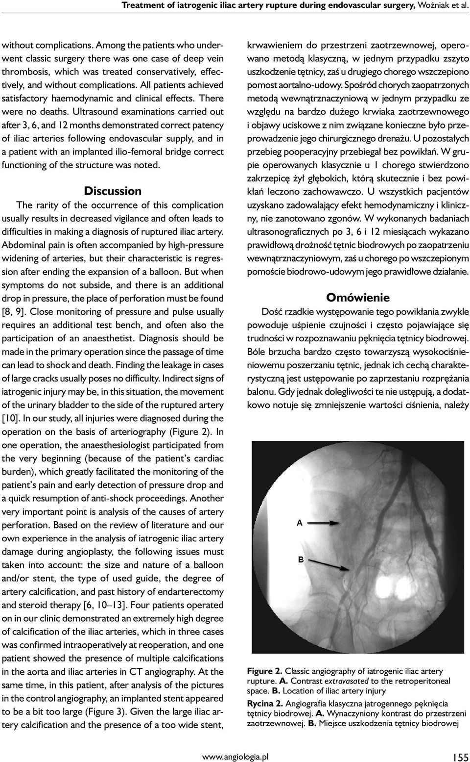 All patients achieved satisfactory haemodynamic and clinical effects. There were no deaths.