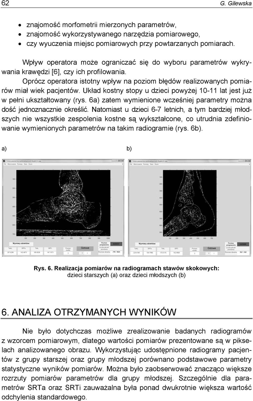 Układ kostny stopy u dzieci powyżej 10-11 lat jest już w pełni ukształtowany (rys. 6a) zatem wymienione wcześniej parametry można dość jednoznacznie określić.