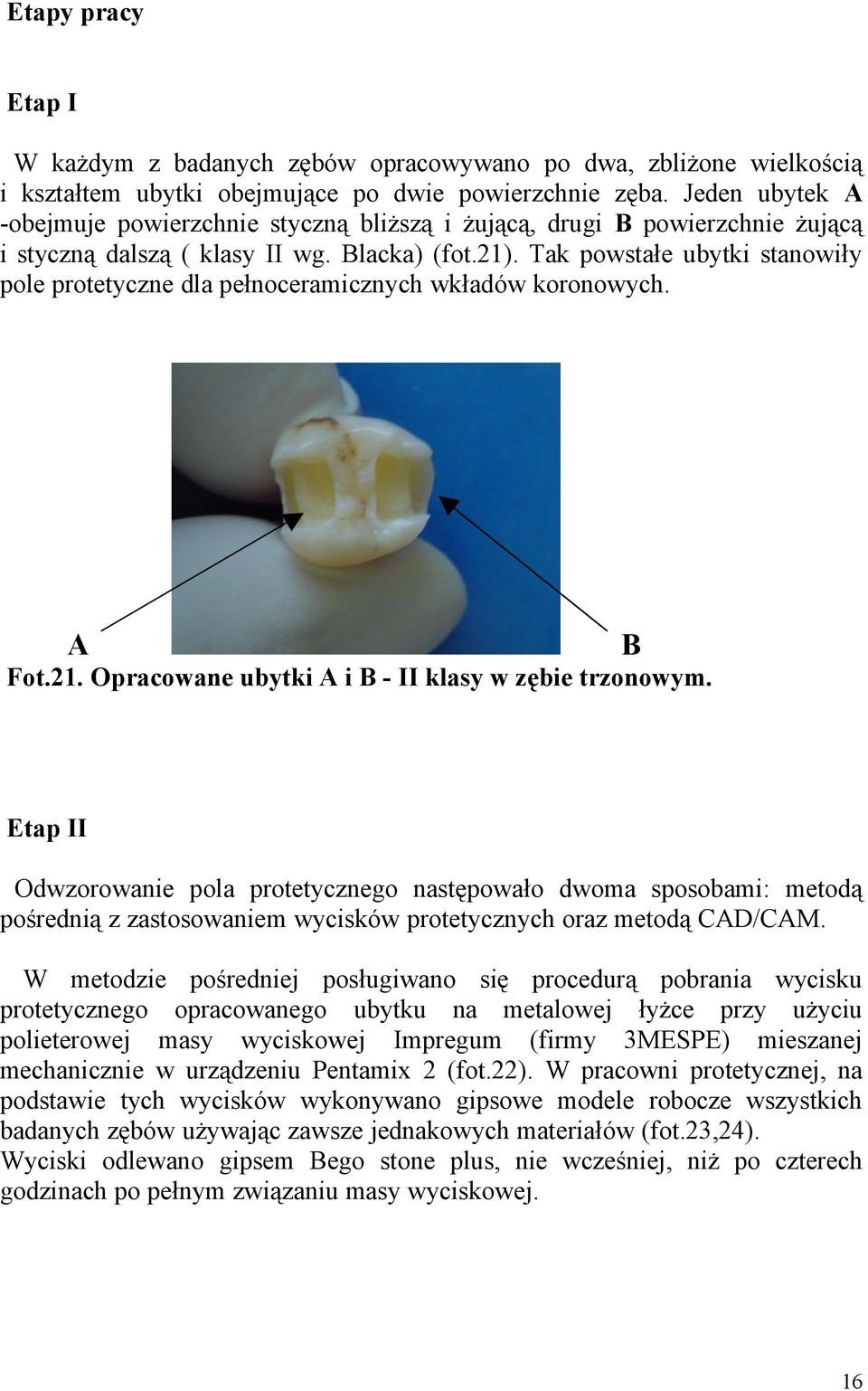 Tak powstałe ubytki stanowiły pole protetyczne dla pełnoceramicznych wkładów koronowych. A B Fot.21. Opracowane ubytki A i B - II klasy w zębie trzonowym.