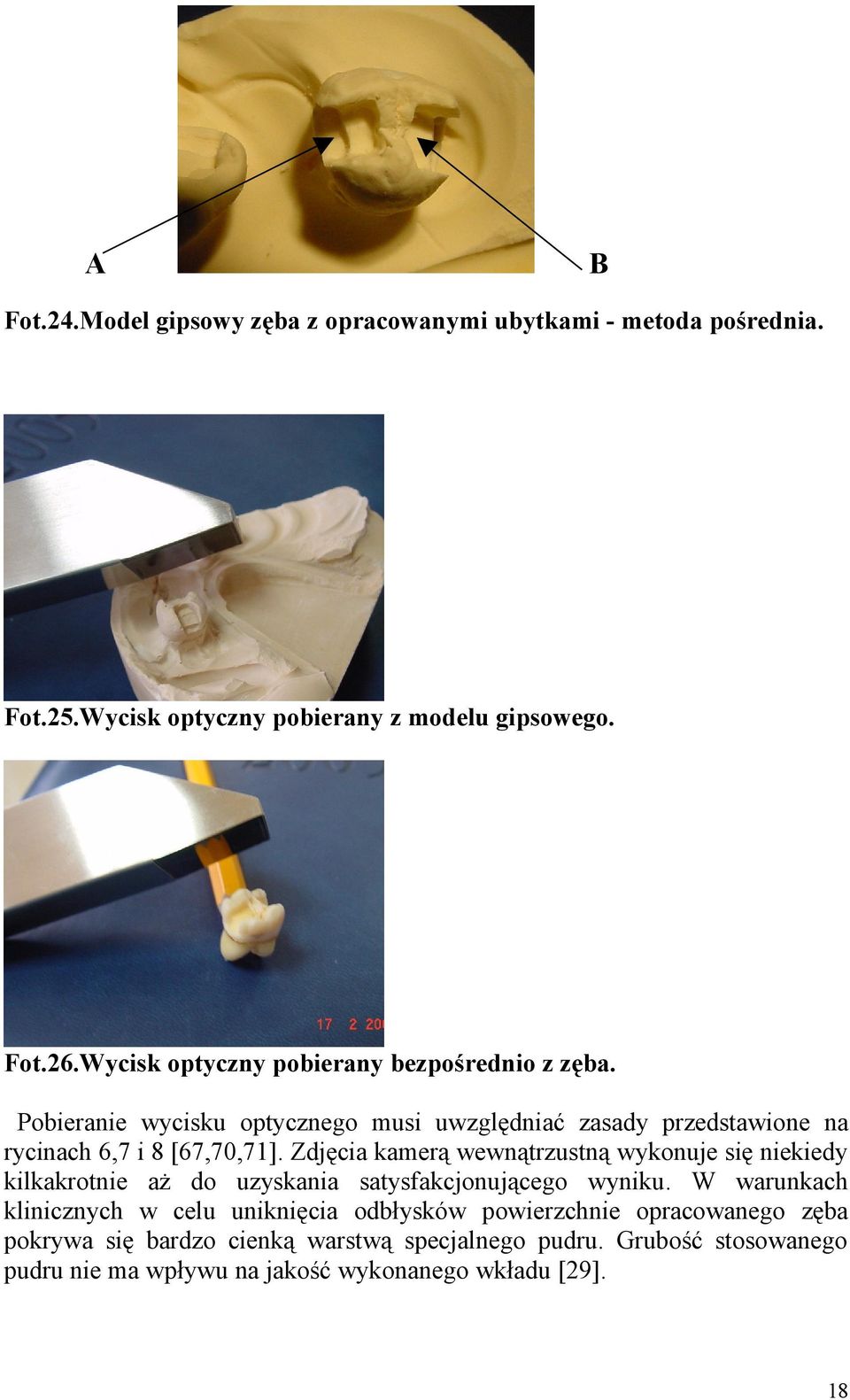 Zdjęcia kamerą wewnątrzustną wykonuje się niekiedy kilkakrotnie aż do uzyskania satysfakcjonującego wyniku.