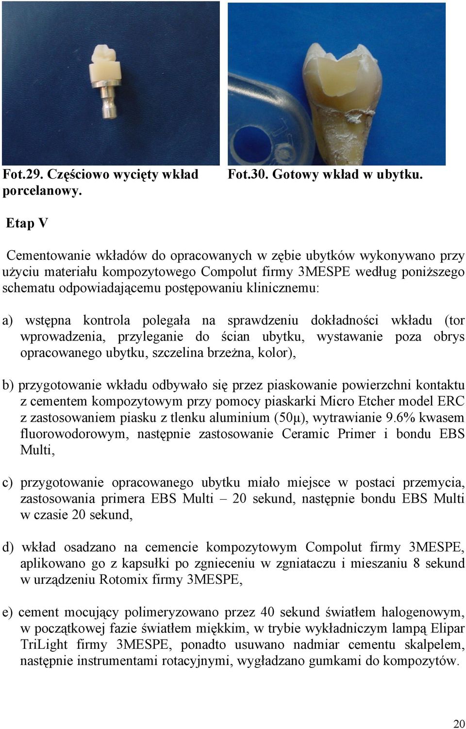 a) wstępna kontrola polegała na sprawdzeniu dokładności wkładu (tor wprowadzenia, przyleganie do ścian ubytku, wystawanie poza obrys opracowanego ubytku, szczelina brzeżna, kolor), b) przygotowanie