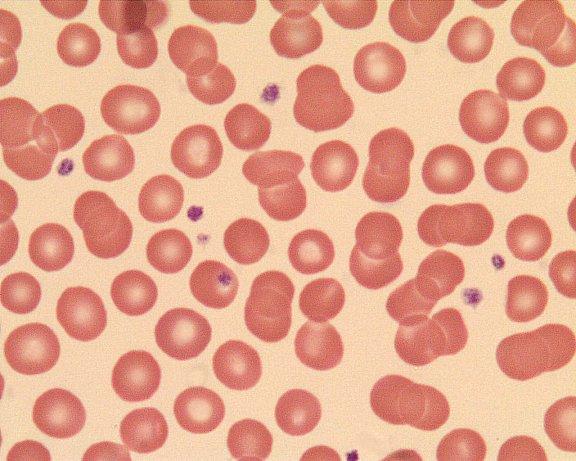 Erytrocyty Leukocyty limfocyty (T i B) monocyty granulocyty obojętnochłonne