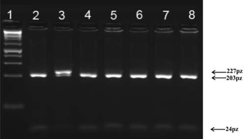 Łukaszewski T, et al. Tabela I. Częstość występowania genotypów i alleli polimorfizmu G20877A genu TLR-2. Tabela II. Częstość występowania genotypów i alleli polimorfizmu C8993T genu TLR-4.