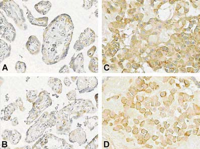 Ryc. 1. Ekspresja aromatazy w centralnych częściach łożysk ludzkich pochodzących z porodów terminowych (A, C) i przedwczesnych (B, D) w syncytiotrofoblaście (A, B) i komórkach doczesnowych (C, D).