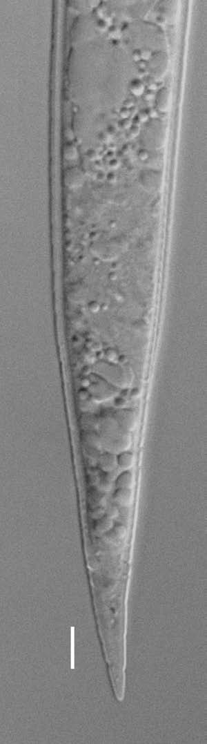 14 Diagnostyka nicieni pasożytów roślin objętych regulacjami prawnymi Meloidogyne hapla (Fot. 7a i 7b) Samice: Ciało zaokrąglone lub kształtu gruszki. W przedniej części ciała wyodrębniona szyjka.