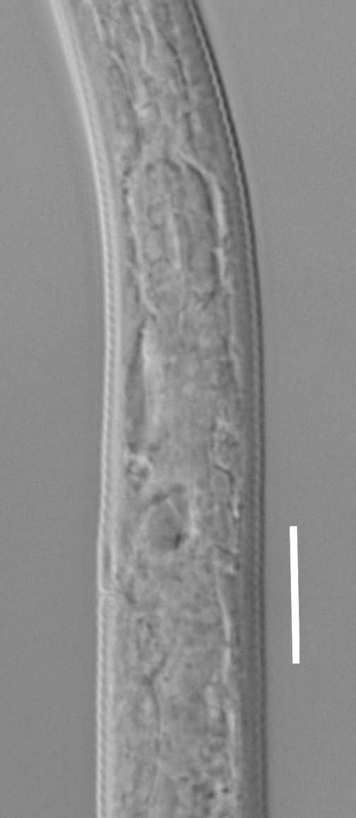 Instrukcja rozpoznawania gatunków z rodzaju Meloidogyne 7 (a) (b) Fot. 1. Ujście gruczołów gardzieli samca Meloidogyne (a), hemizonid osobnika młodocianego stadium J 2 Meloidogyne (b).