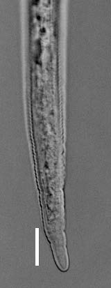 8 Diagnostyka nicieni pasożytów roślin objętych regulacjami prawnymi 1.2. Charakterystyka gatunków Meloidogyne ardenensis (Fot. 2) Samice: Ciało w kształcie gruszki z wyraźnie wydłużoną szyjką.