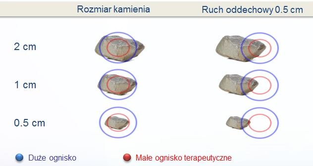 Pytanie nr 18: Z uwagi na ratalną formę płatności prosimy o udostępnienie Wykonawcom na stronie internetowej Zamawiającego rachunku wyników. Bilansu za dwa ostanie lata i okres bieżący.