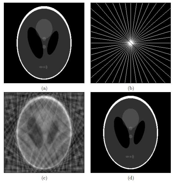 Compressed Sensing przykłady, zastosowania Tomografia Komputerowa