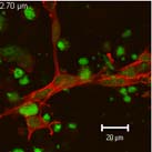 TECHNIKI badania in vitro komórki satelitowe badania in vivo regeneracja mięśni