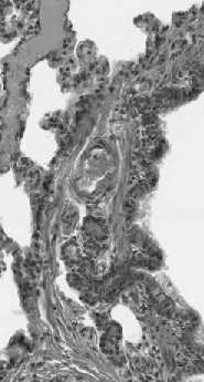 Makrofagi pęcherzykowe przyczepione do wewnętrznej powierzchni pęcherzyków płucnych fagocytują cząstki pyłów i mikroorganizmy, które nie zostały zatrzymane w drogach oddechowych, a także eliminują