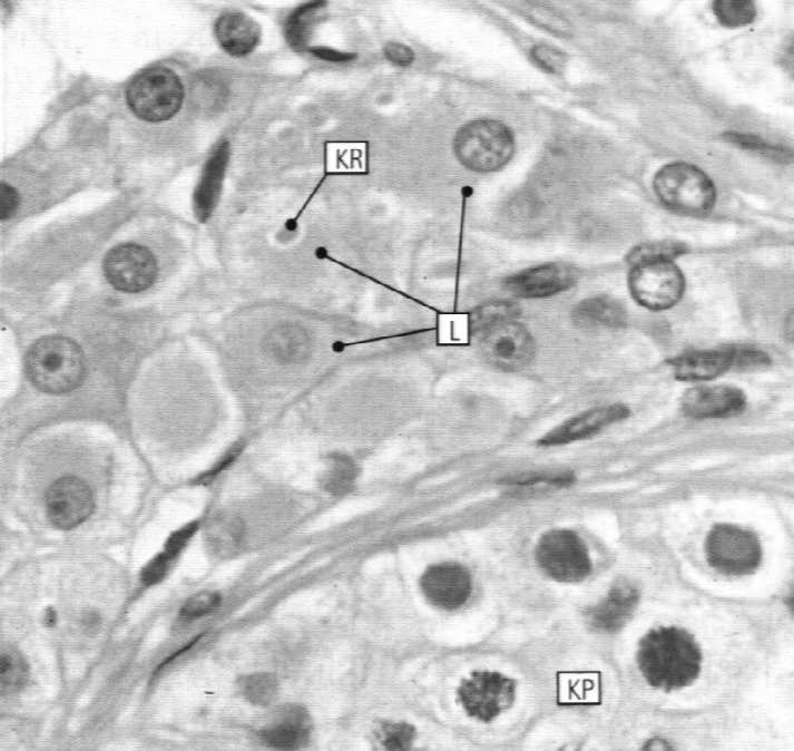 szyjka Spermiogeneza aparat Golgiego obejmuje następujące procesy: wytworzenie akrosomu (fuzja pęcherzyków pochodzących z aparatu Golgiego) Dojrzały plemnik mankiet mitochondrialny akrosom główka: