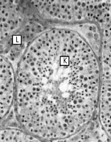 mitochondrialnego utworzenie wyspecjalizowanych obszarów błony komórkowej usunięcie zbędnej cytoplazmy (ciałko resztkowe, kropla cytoplazmatyczna) witka: - szyjka: centriole otoczone część przez 9