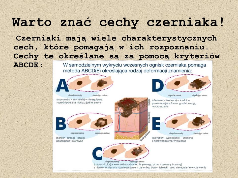 charakterystycznych cech, które