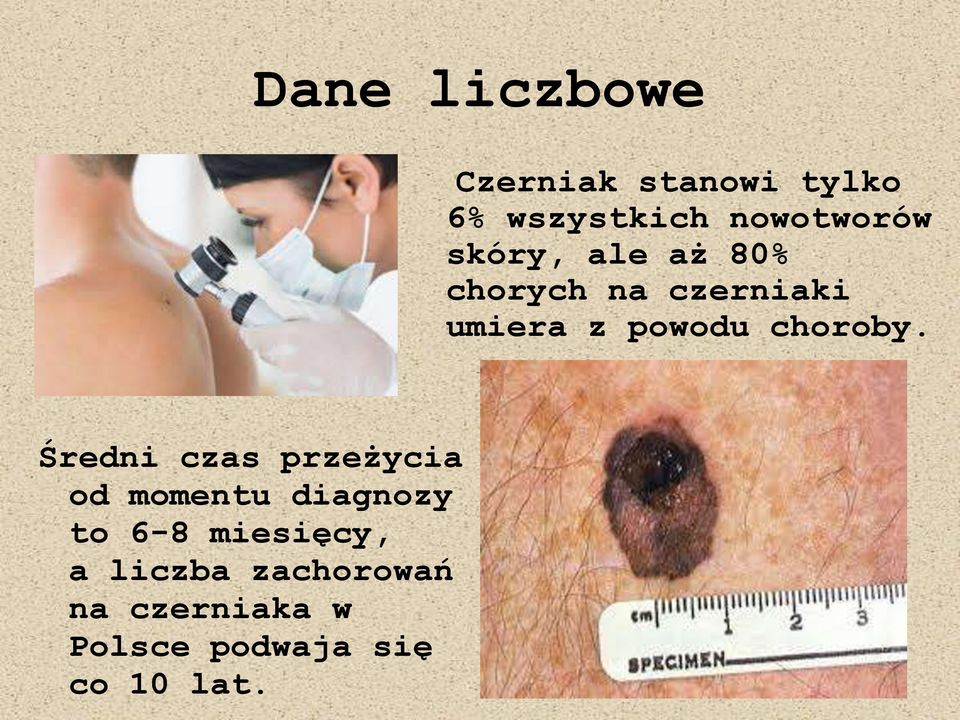 Średni czas przeżycia od momentu diagnozy to 6-8 miesięcy, a