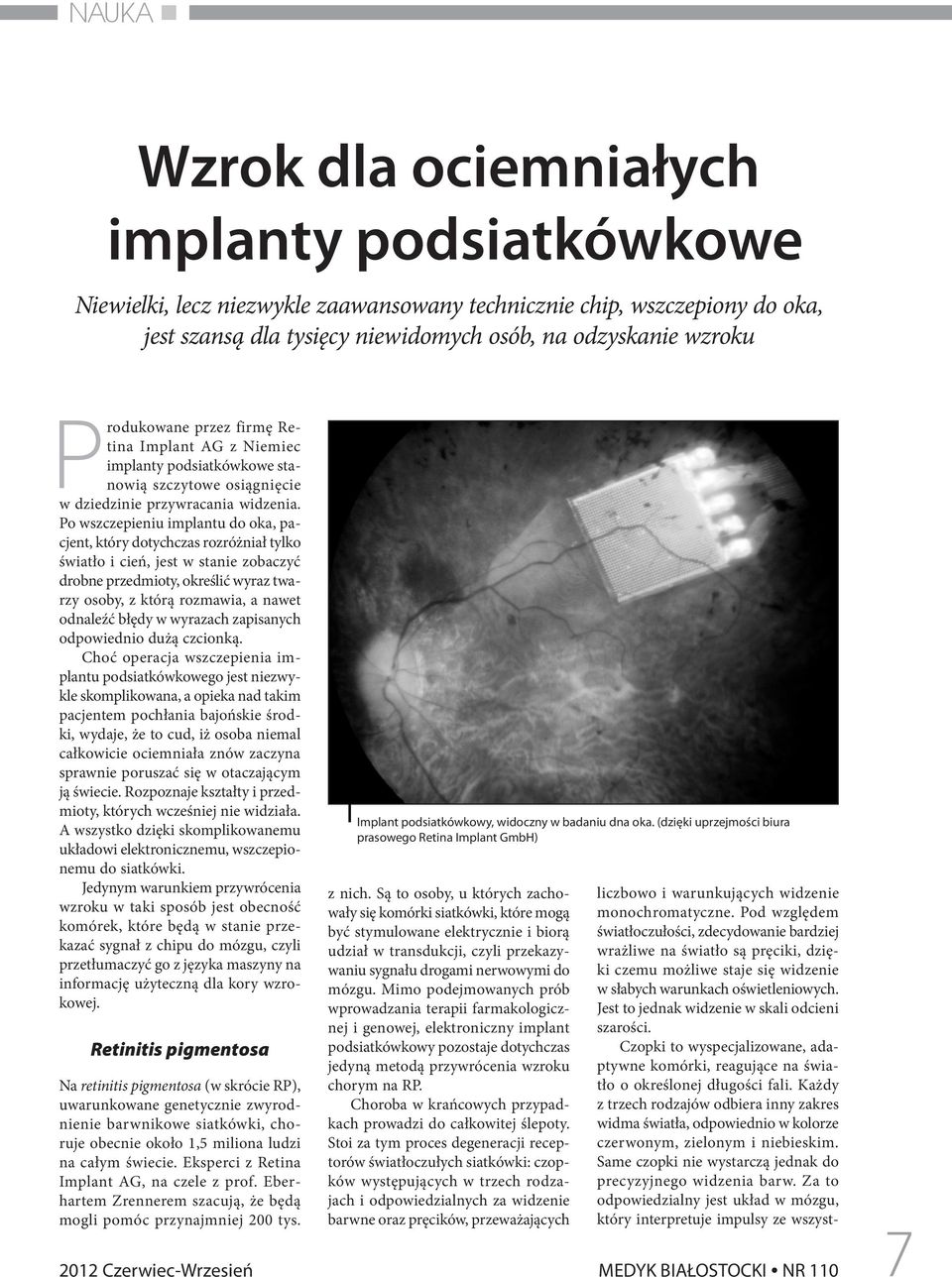 Po wszczepieniu implantu do oka, pacjent, który dotychczas rozróżniał tylko światło i cień, jest w stanie zobaczyć drobne przedmioty, określić wyraz twarzy osoby, z którą rozmawia, a nawet odnaleźć