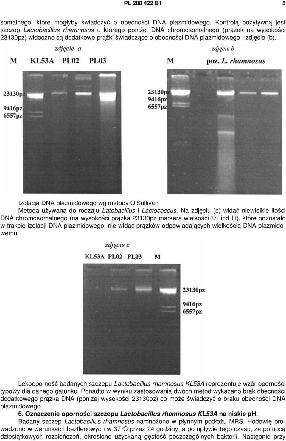 zdjęcie (b). Izolacja DNA plazmidowego wg metody O'Sullivan Metoda używana do rodzaju Latobacillus i Lactococcus.