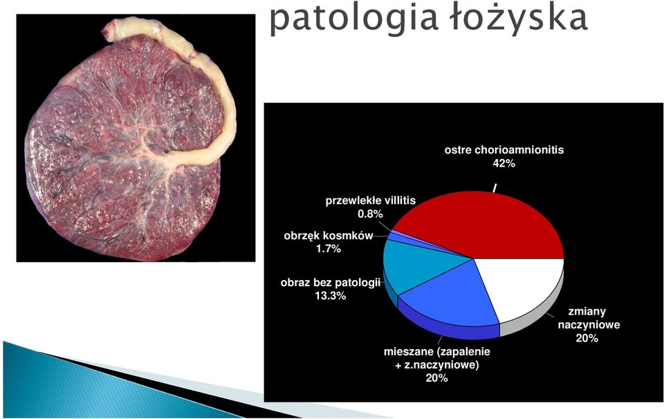 7% obraz bez patologii 13.