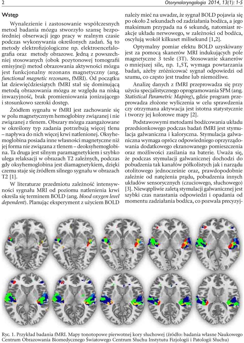 Jedną z powszechniej stosowanych (obok pozytonowej tomografii emisyjnej) metod obrazowania aktywności mózgu jest funkcjonalny rezonans magnetyczny (ang. functional magnetic rezonans, fmri).