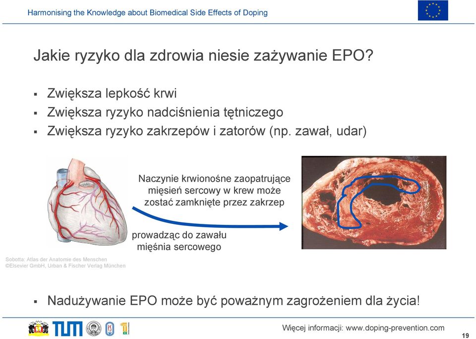 zawał, udar) Naczynie krwionośne zaopatrujące mięsień sercowy w krew może zostać zamknięte przez zakrzep