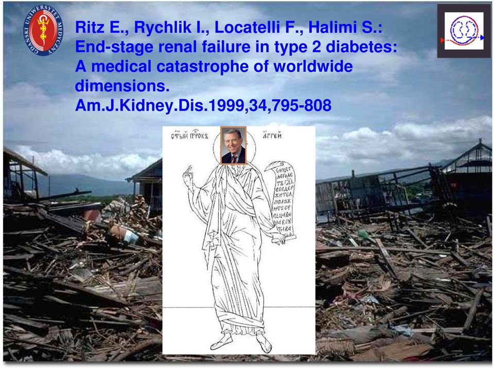 : End-stage renal failure in type 2