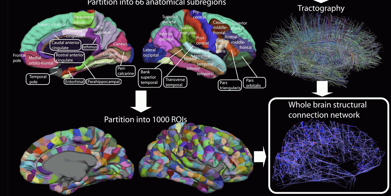 MRI - podziały kory mózgu